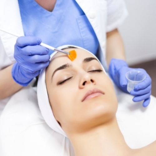 Peeling tratamiento de acné (Salipeel)